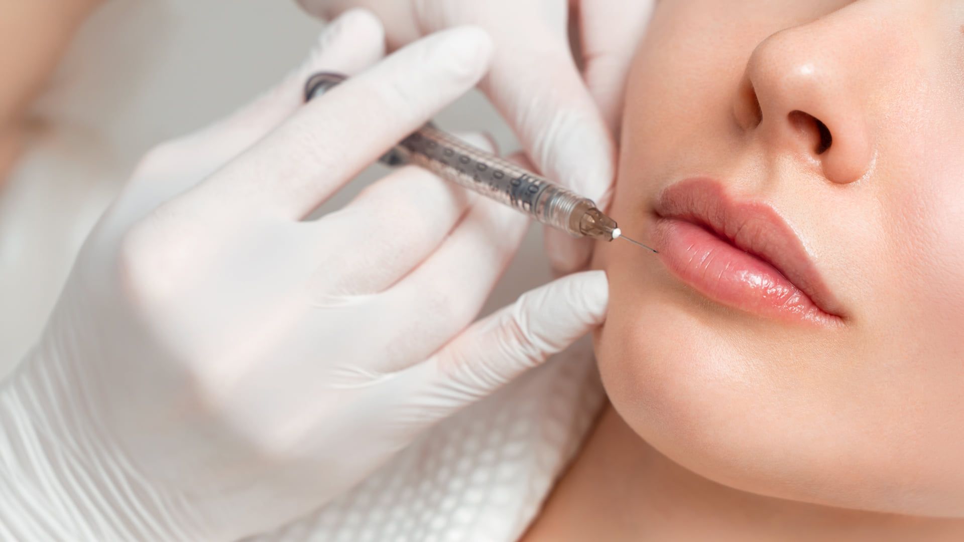 Preenchimento Facial — procedimento
